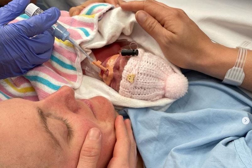 A woman holding a premature baby