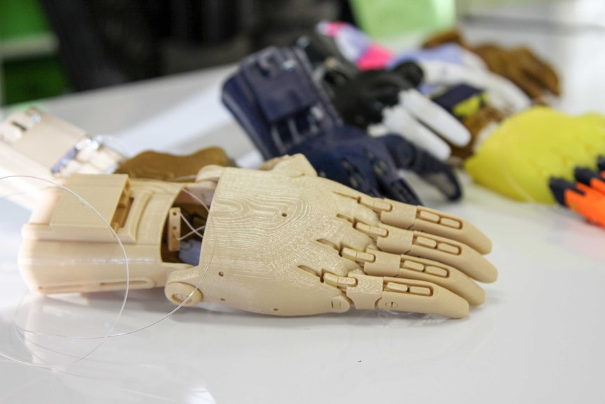 Prosthetic hands