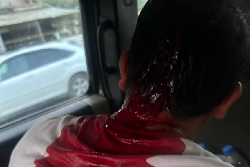 The back of a man's head showing a head wound and blood staining his t-shirt.