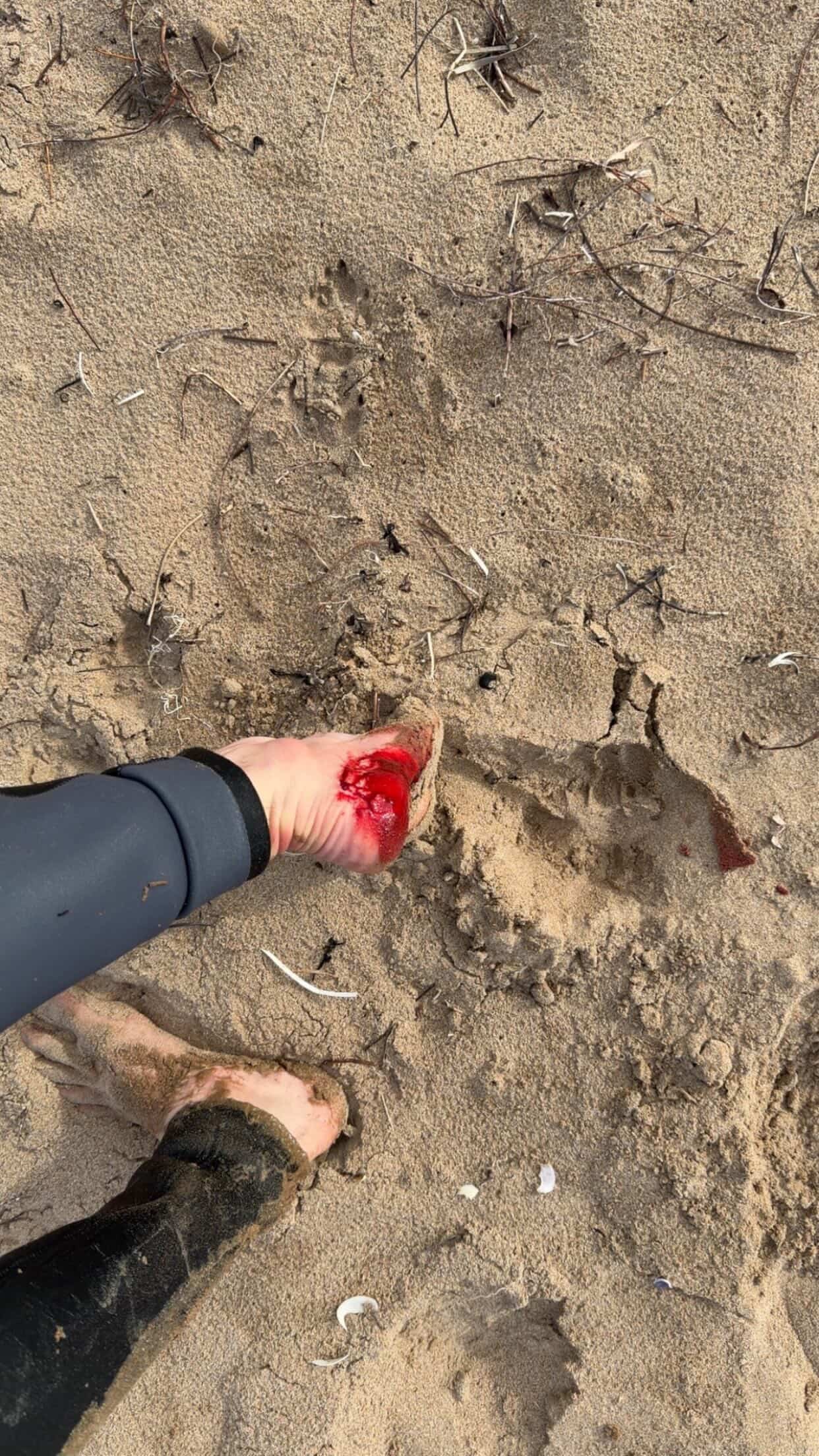 A close up shot of a surfer's feet with blood coming out of the back of one of the ankles