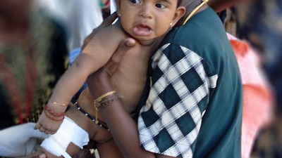 Sri Lankan child treated at refugee camp