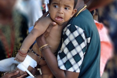 Sri Lankan child treated at refugee camp