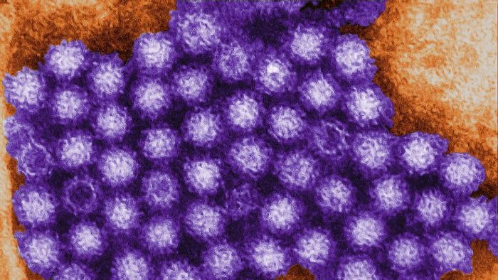 A digitally-colorised transmission electron micrograph of a colony of norovirus.