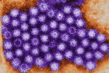 A digitally-colorised transmission electron micrograph of a colony of norovirus.