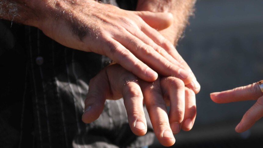 Close up of a man's hands demonstrating the sections of his finger he nearly lost.