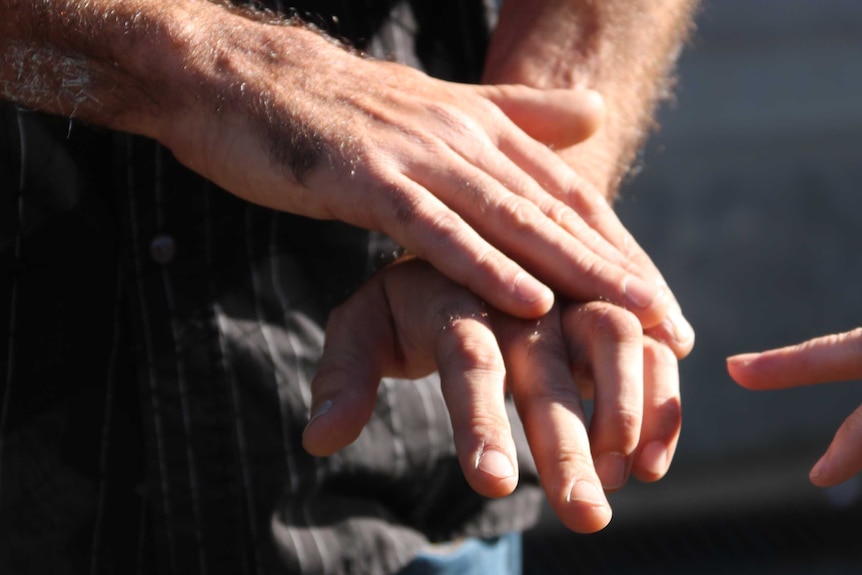 Close up of a man's hands demonstrating the sections of his finger he nearly lost.