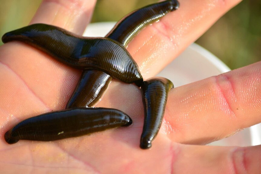 Leeches on a hand