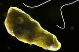 An image of a single-celled amoeba