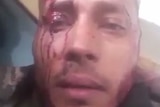 Oscar Perez in a grainy close-up photograph with blood on his face