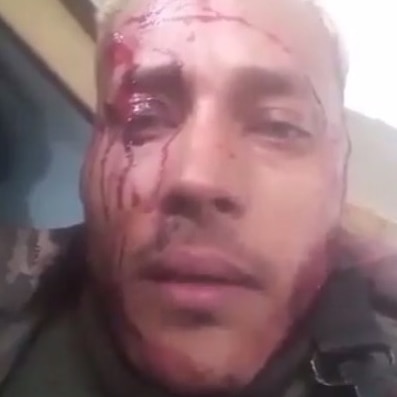 Oscar Perez in a grainy close-up photograph with blood on his face