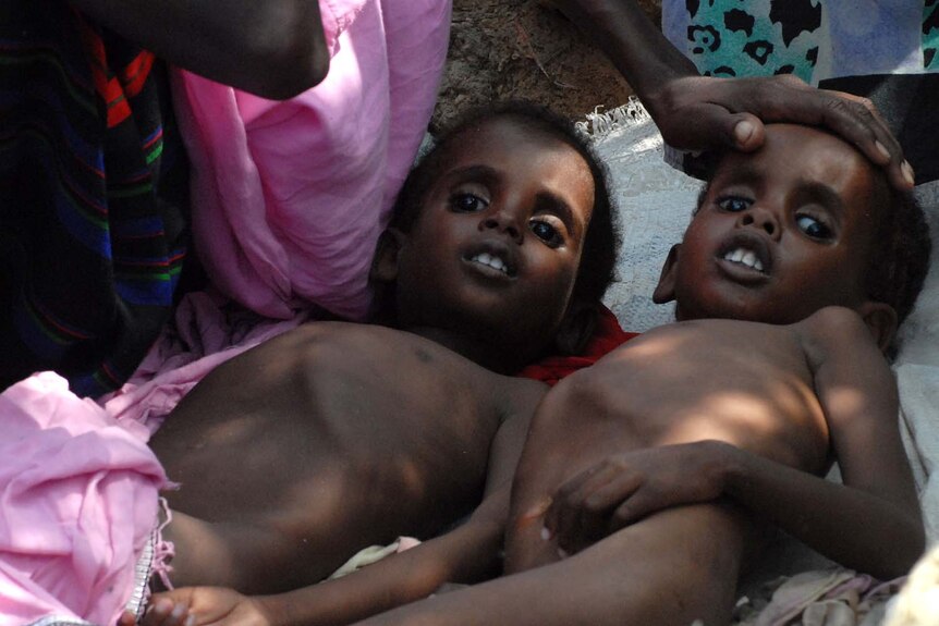 Two children suffering from malnutrition lie at a Mogadishu camp.