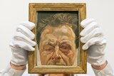 A painting titled Self-Portrait with a Black Eye by British artist Lucian Freud.