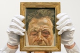 A painting titled Self-Portrait with a Black Eye by British artist Lucian Freud.