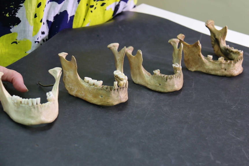 Four human jawbones sit on a table in a laboratory.