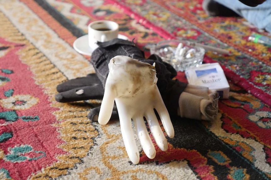 A fake plastic hand rests on a glove and an ashtray