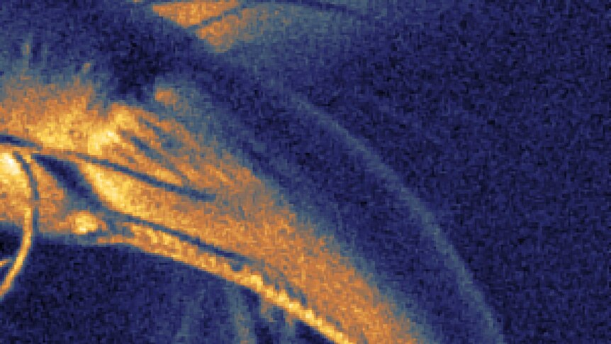 A spider fang under examination by the scanning helium microscope.