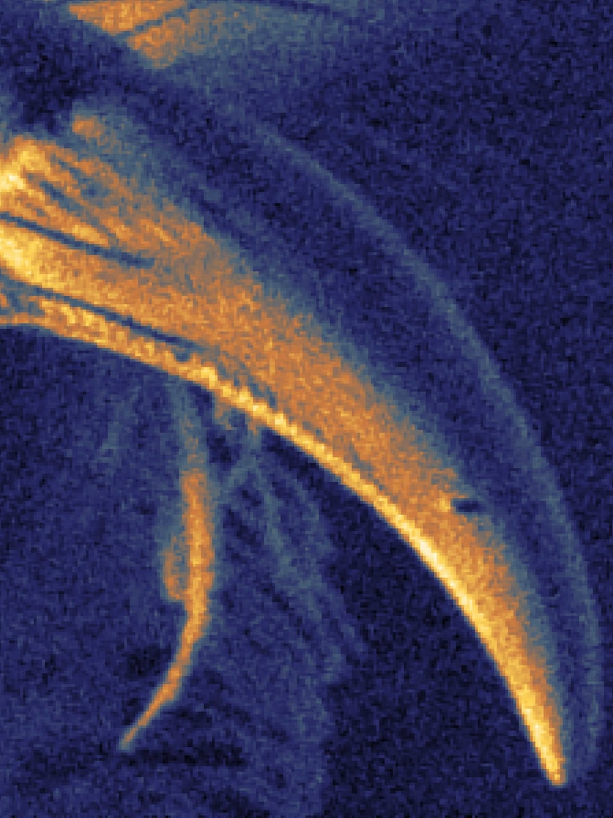 A spider fang under examination by the scanning helium microscope.