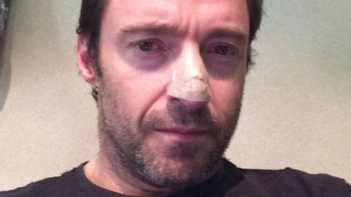 Jackman posts picture on Instagram skin cancer diagnosis