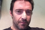 Hugh Jackman has posted a picture on Instagram after he was diagnosed with basil cell carcinoma