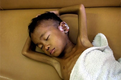 A young Cambodian boy, suffering from AIDS, falls asleep while waiting to see a doctor.