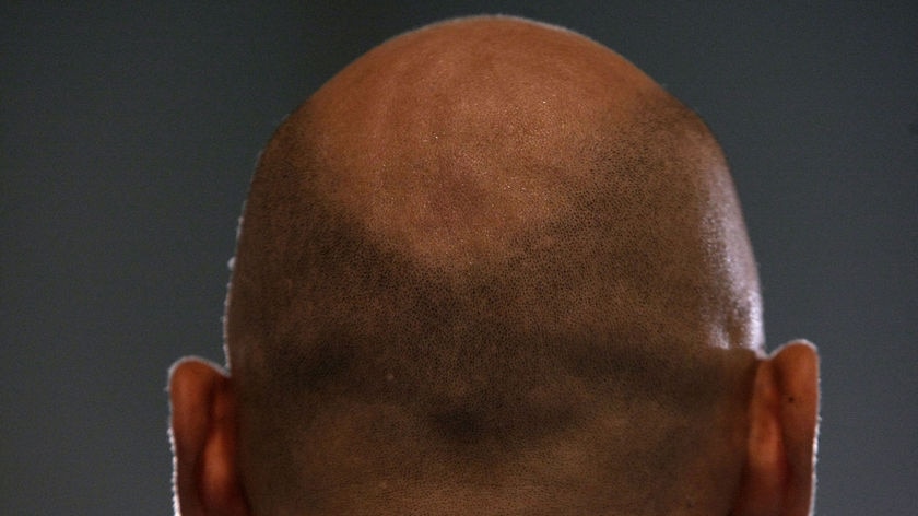 A generic shot of a bald man's head from behind