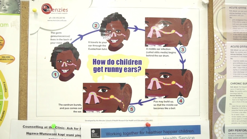 A diagram reads: "How do children get runny ears?" as a five-stage process shows the germ movements