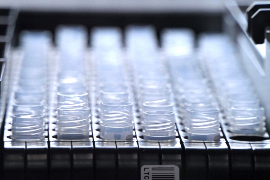 A close-up photograph of dozens of COVID-19 tests positioned in a tray.