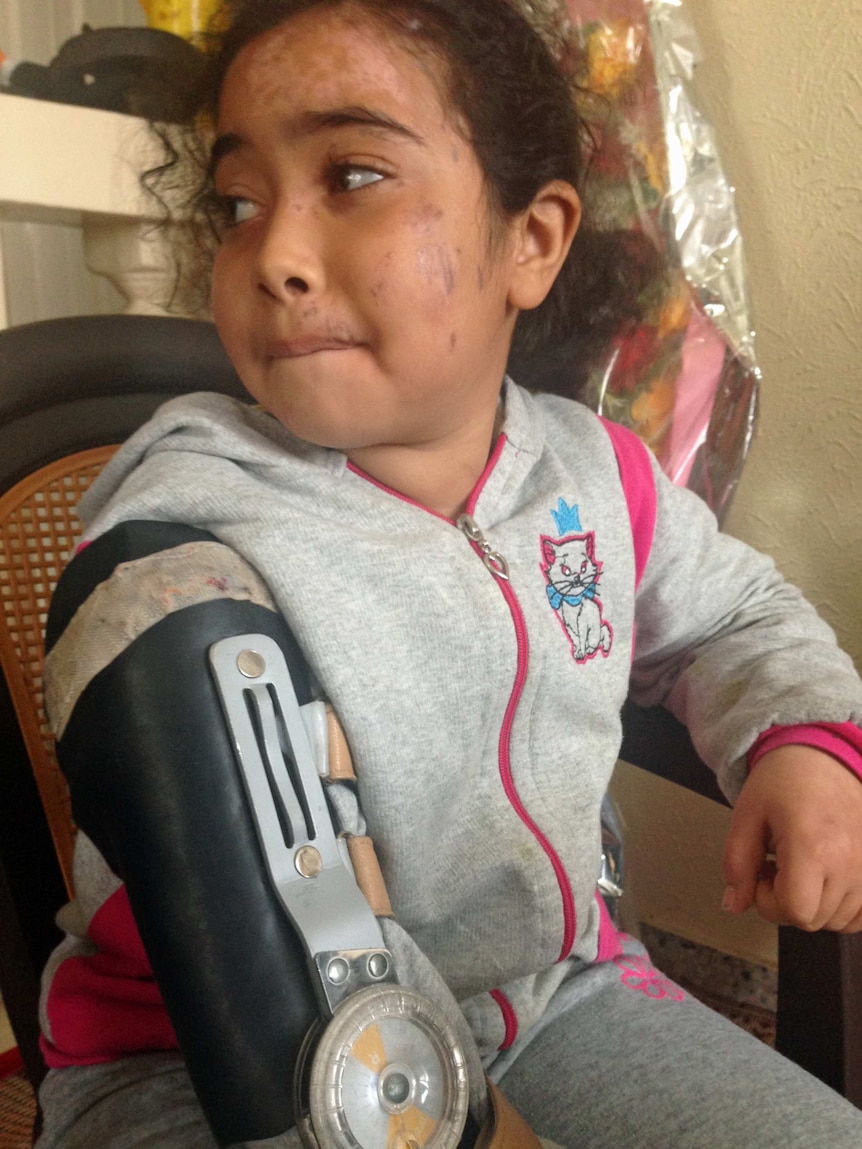 Ten-year-old Haneen has burns on her face and wears a brace on one arm.