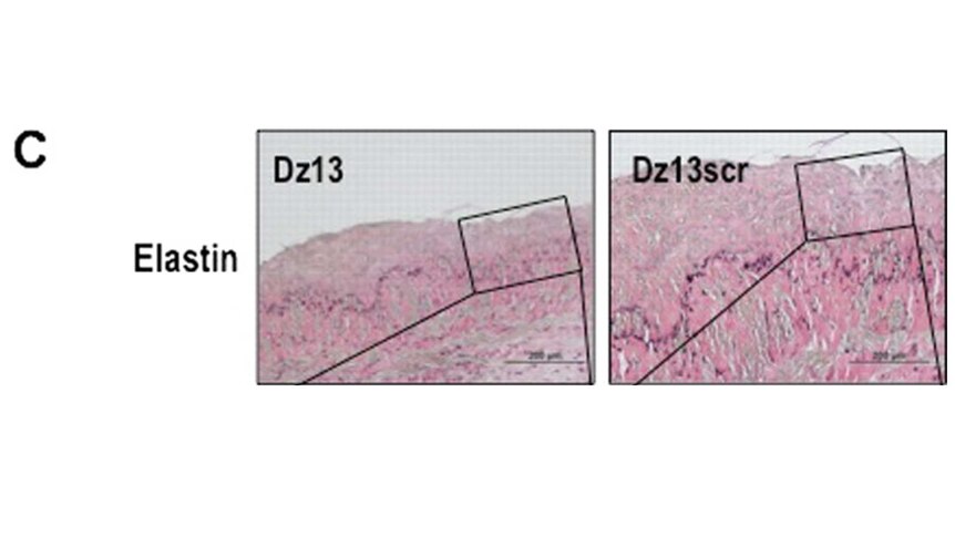 A graphic of two cell structures with the labels Elastin, Dz13 and Dz13scr
