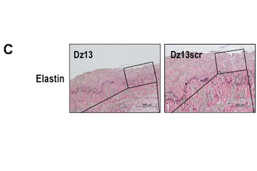 A graphic of two cell structures with the labels Elastin, Dz13 and Dz13scr