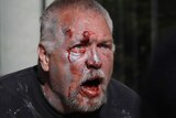 A white man is seen with blood smeared on his face and in his mouth. He has short grey hair and his mouth is open.