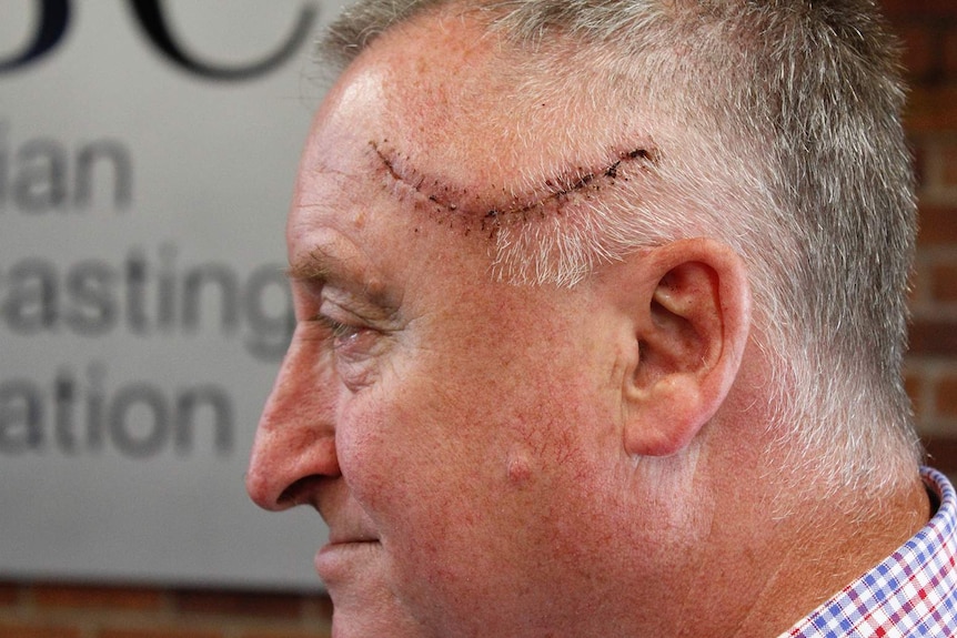The wound Rod Patterson received during the Bourke Street attack
