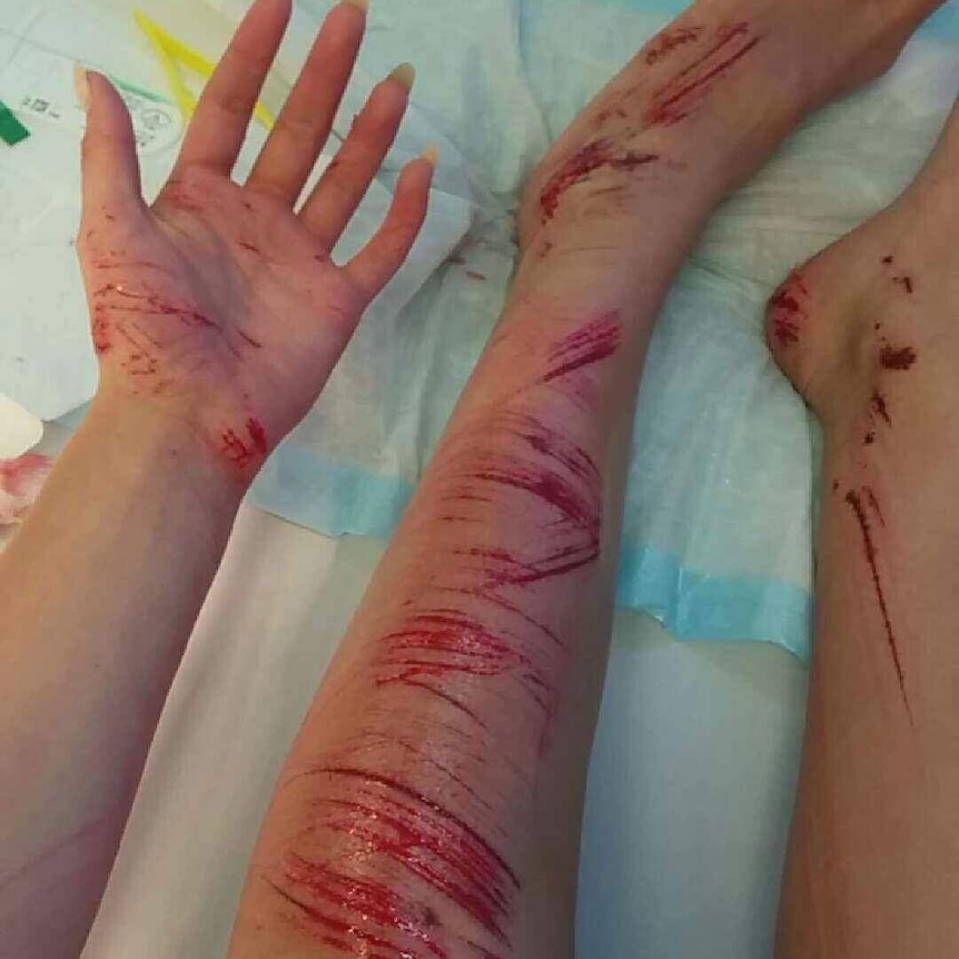 Scratches on a teenager's arms and legs.