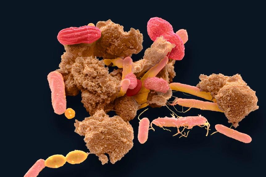 Microscope view of bacteria coloured brown, red and orange