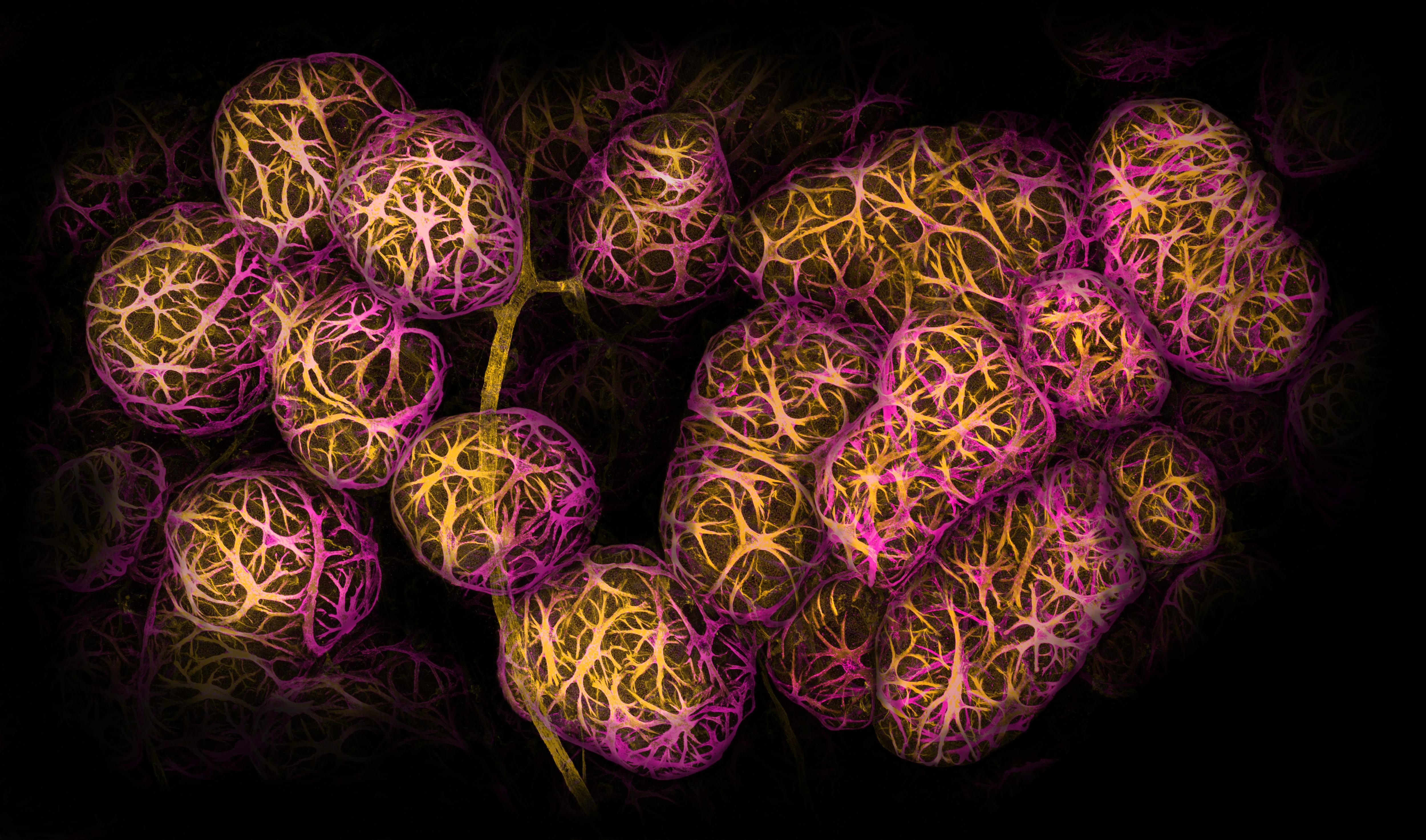 an extremely close-up image of cells inside human breast tissue, they look like spiderweb-covered spheres in pink and yellow