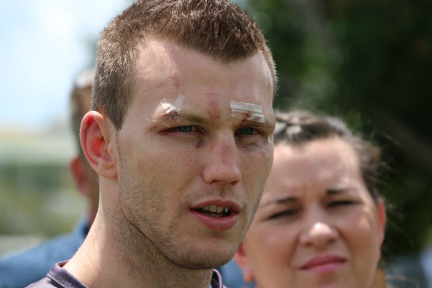 A headshot of Jeff Horn shows numerous cuts on his face.