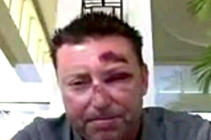 Golfer Robert Allenby speaks about his kidnapping, beating and robbery in Hawaii in January 2015.