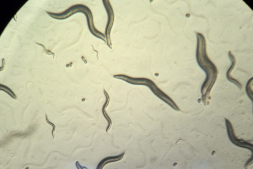 Photo of microscopic worm