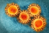 Four yellow circles with spikes and red centre, on blue background.