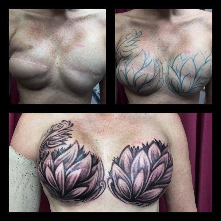 Three series of photos showing a woman's breasts with tattoos drawn over the top of reconstructive surgery scars.