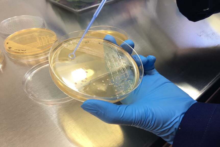Scientist takes swabs of bacteria to mix in a solution