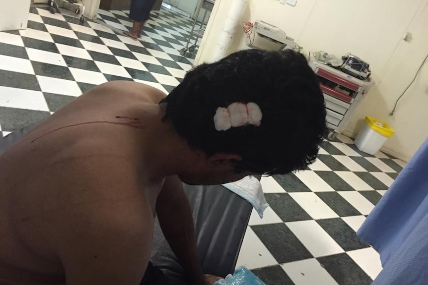 A man sits in hospital with  a bandage on the back of his head and blood dripping down his back