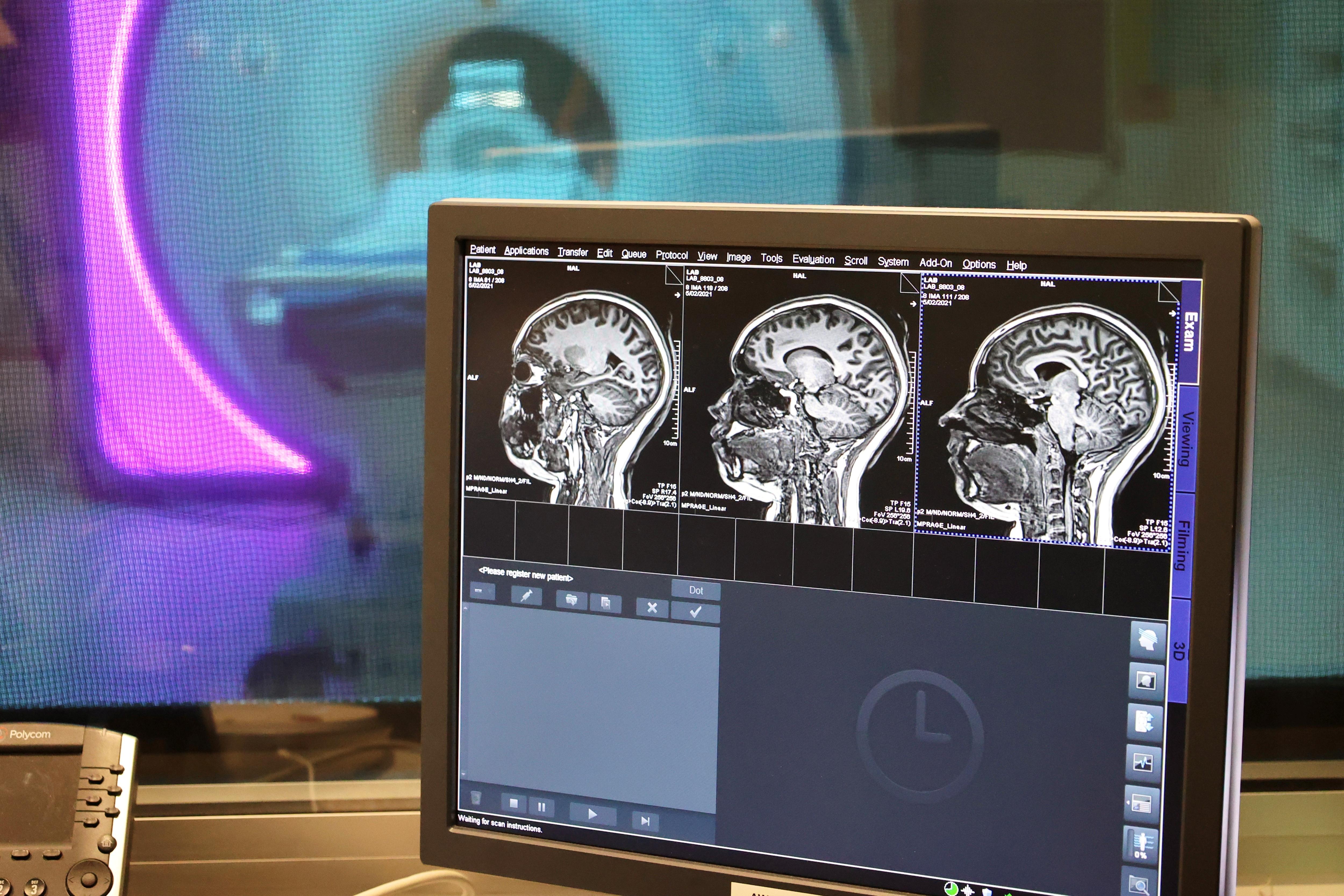 A photo of brain scans