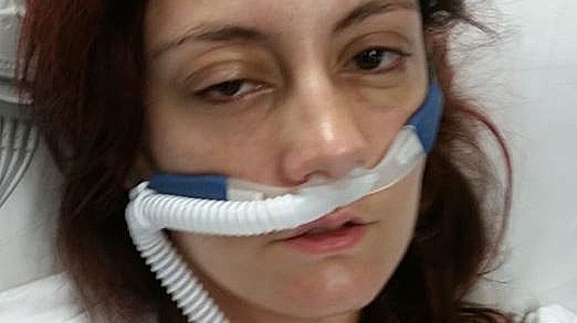 Amanda Nix in hospital with a breathing tube attached to her nose.