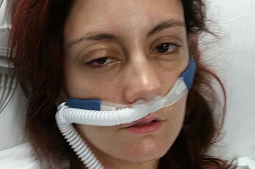 Amanda Nix in hospital with a breathing tube attached to her nose.