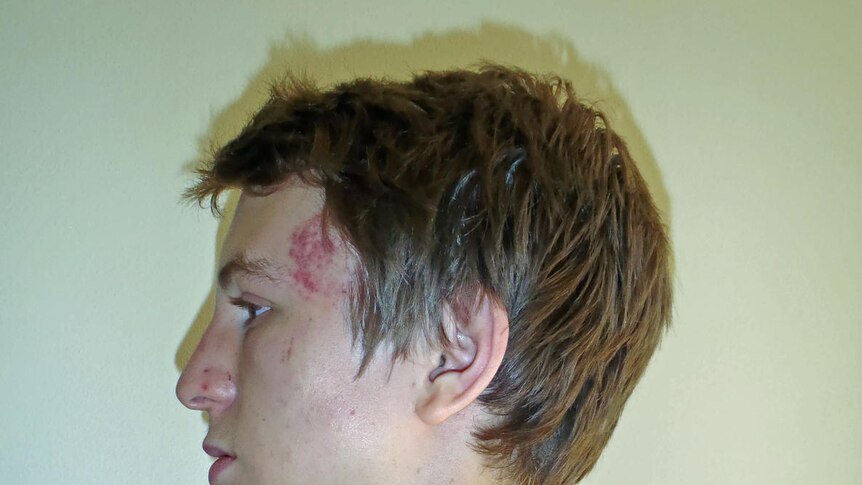 Profile of Midland man 'Reuben' who was assaulted at Guildford