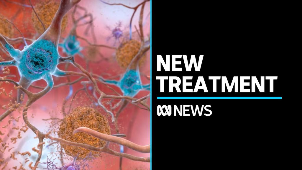 World On The Cusp Of New Treatment To Slow Down Alzheimer's Disease ...