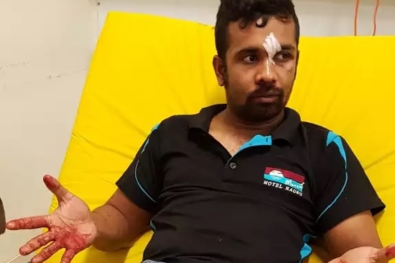 Kamal Parvez at a hospital in Nauru after receiving treatment. There is blood on his hands and bandages between his eyes.