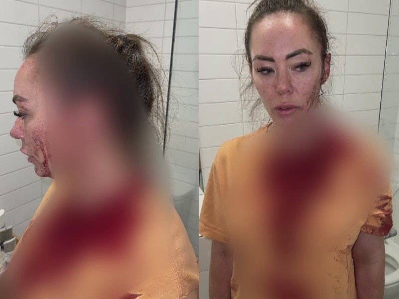 a composite image of victim of domestic violence Rhiannon Purcell showing her bloodied