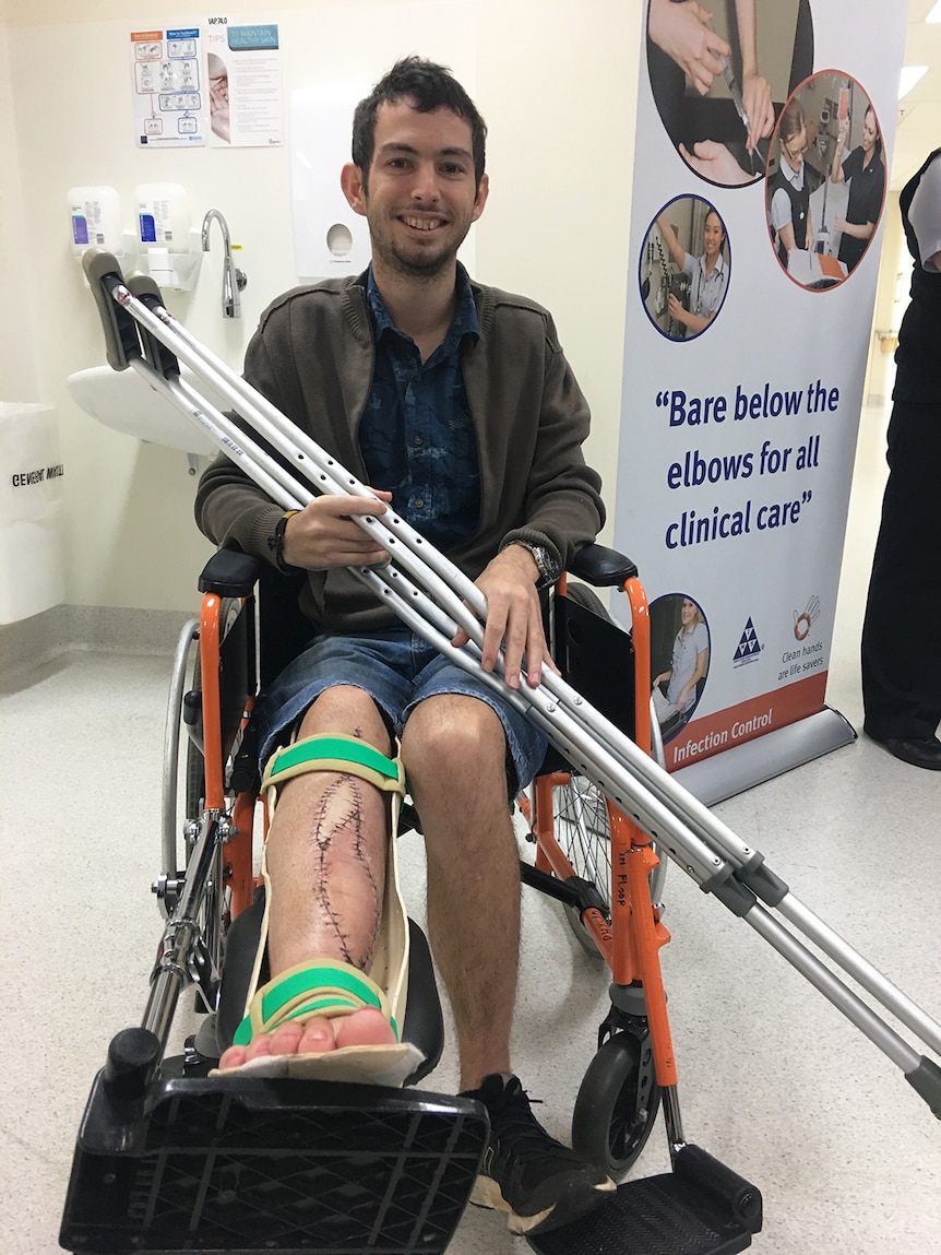 Reuben Lichter now has a 3D printed tibia.